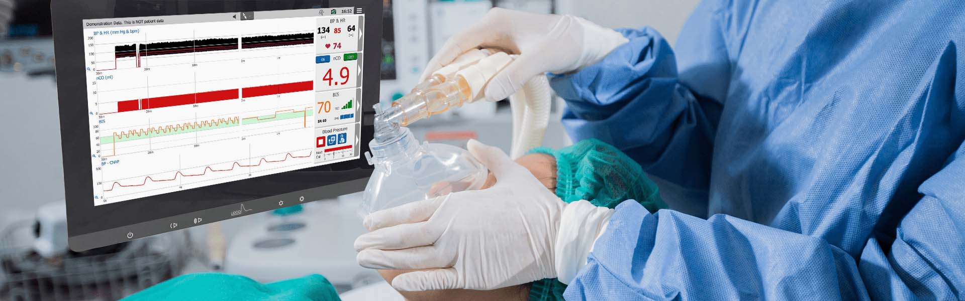 5541 Anesthetist With Hemodynamic Monitor LiDCO Hemodynamic