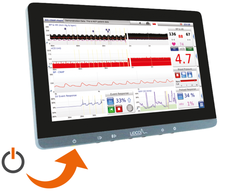 Lidcounity Lidco Hemodynamic Monitoring For The Entire Patient Pathway