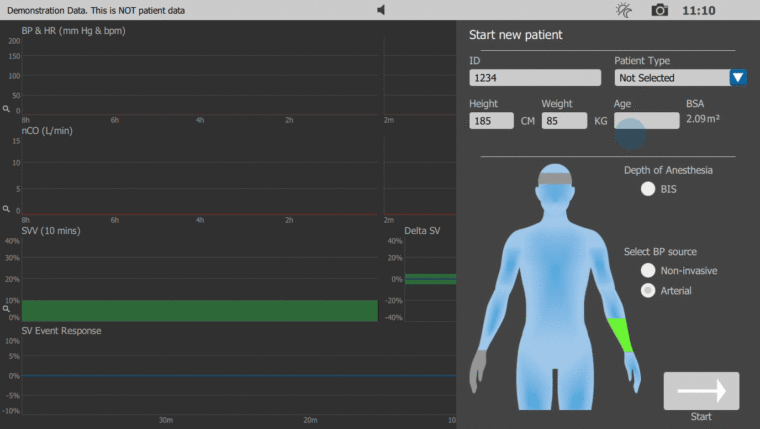 How to Setup Minimally Invasive Hemodynamic Monitoring (V3.06) | LiDCO ...